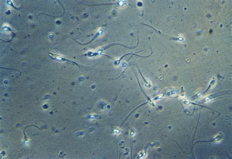 Sperm stain. Things To Know About Sperm stain. 